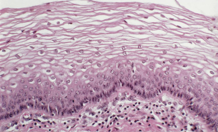 <p>what tissue is this </p>