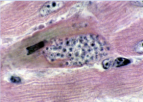<p>in human or animal</p><p>fatigue</p>