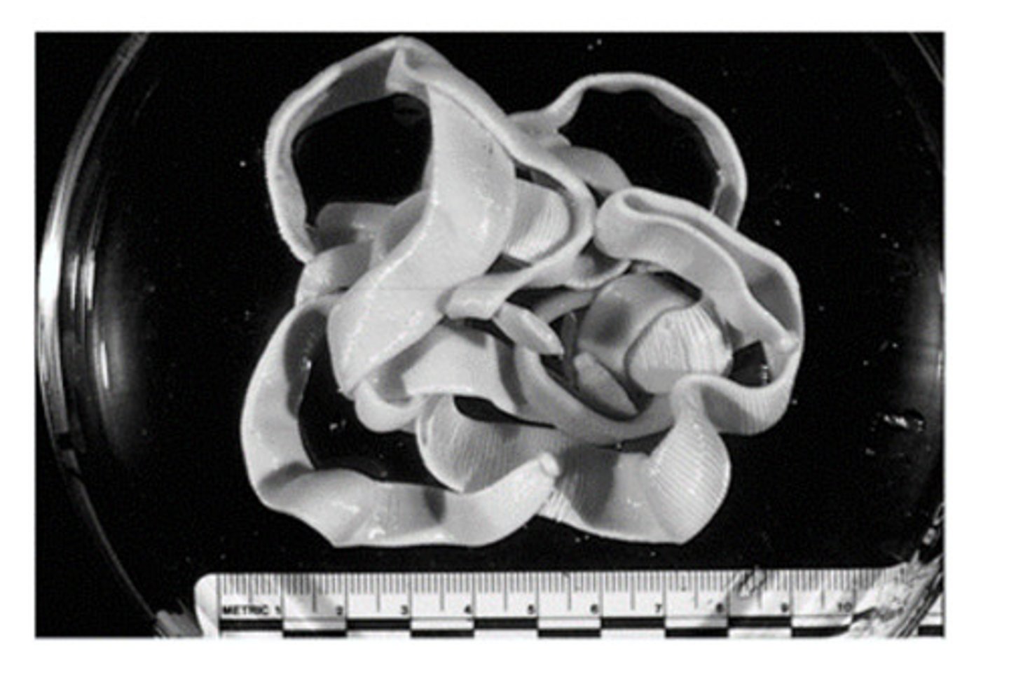 <p>The equine tapeworm with a large scolex, seen here, lacks lappets. The genus and species is...</p>