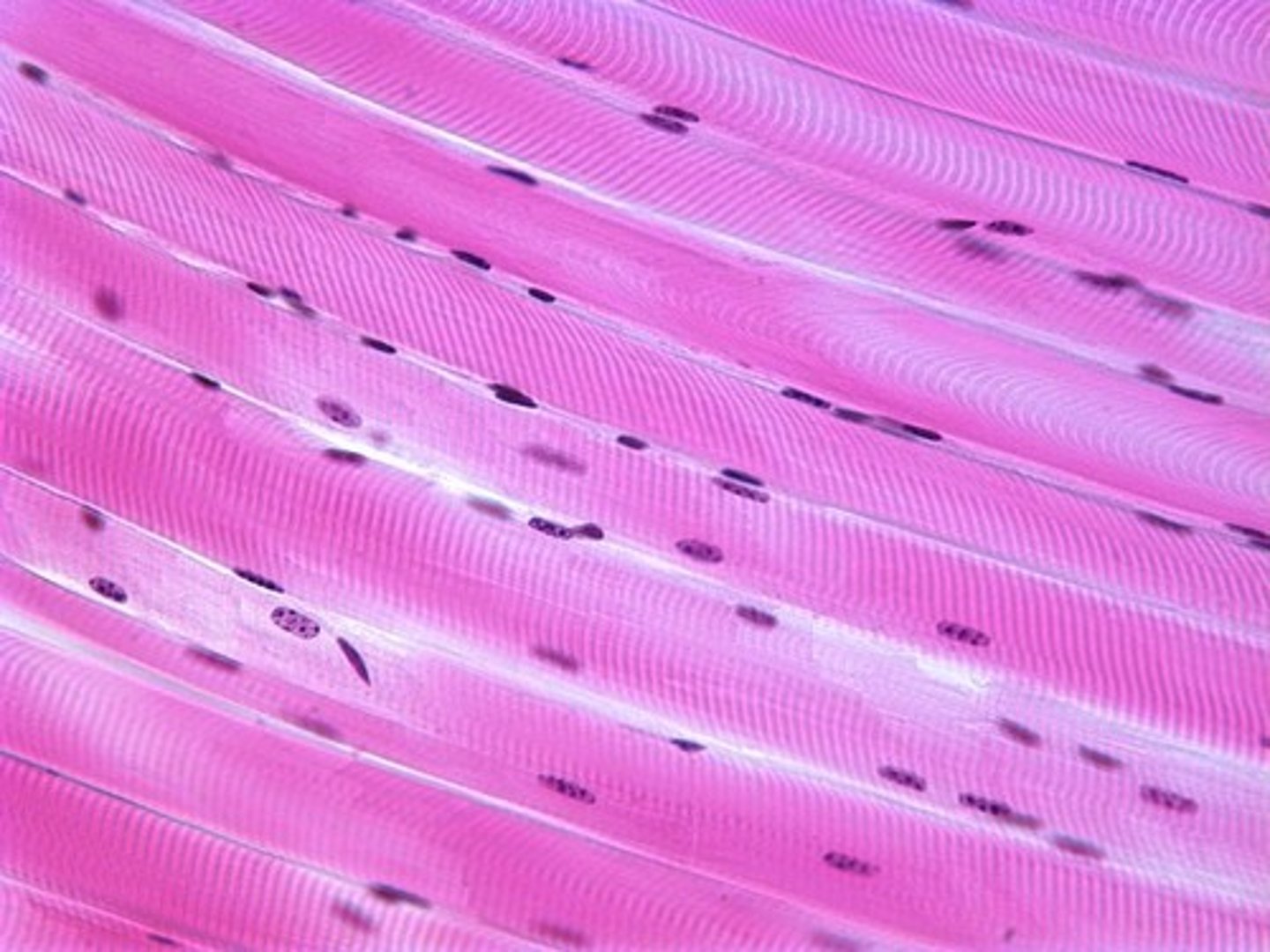 <p>attaches to bone and skin. Long, striated, multinucliated cells. Voluntary action muscle.</p>