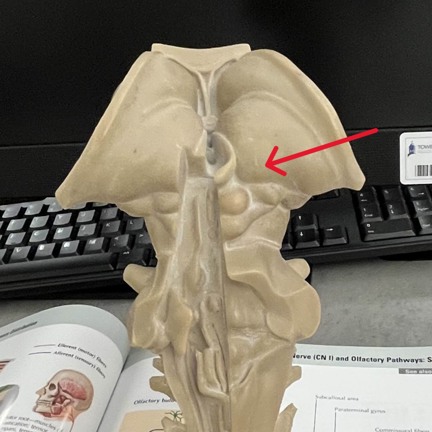<p>Which part of the thalamus is:</p><ul><li><p>Largest nucleus </p></li><li><p>Brown oval</p></li></ul><p></p>