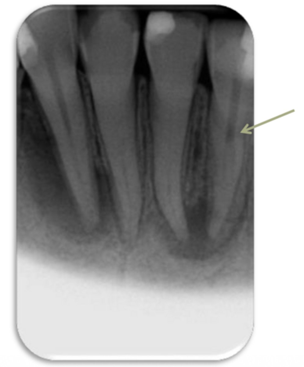 <p>ID the problem:</p>