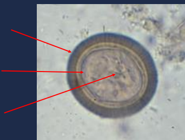 State the name of the upper portion of the picture.