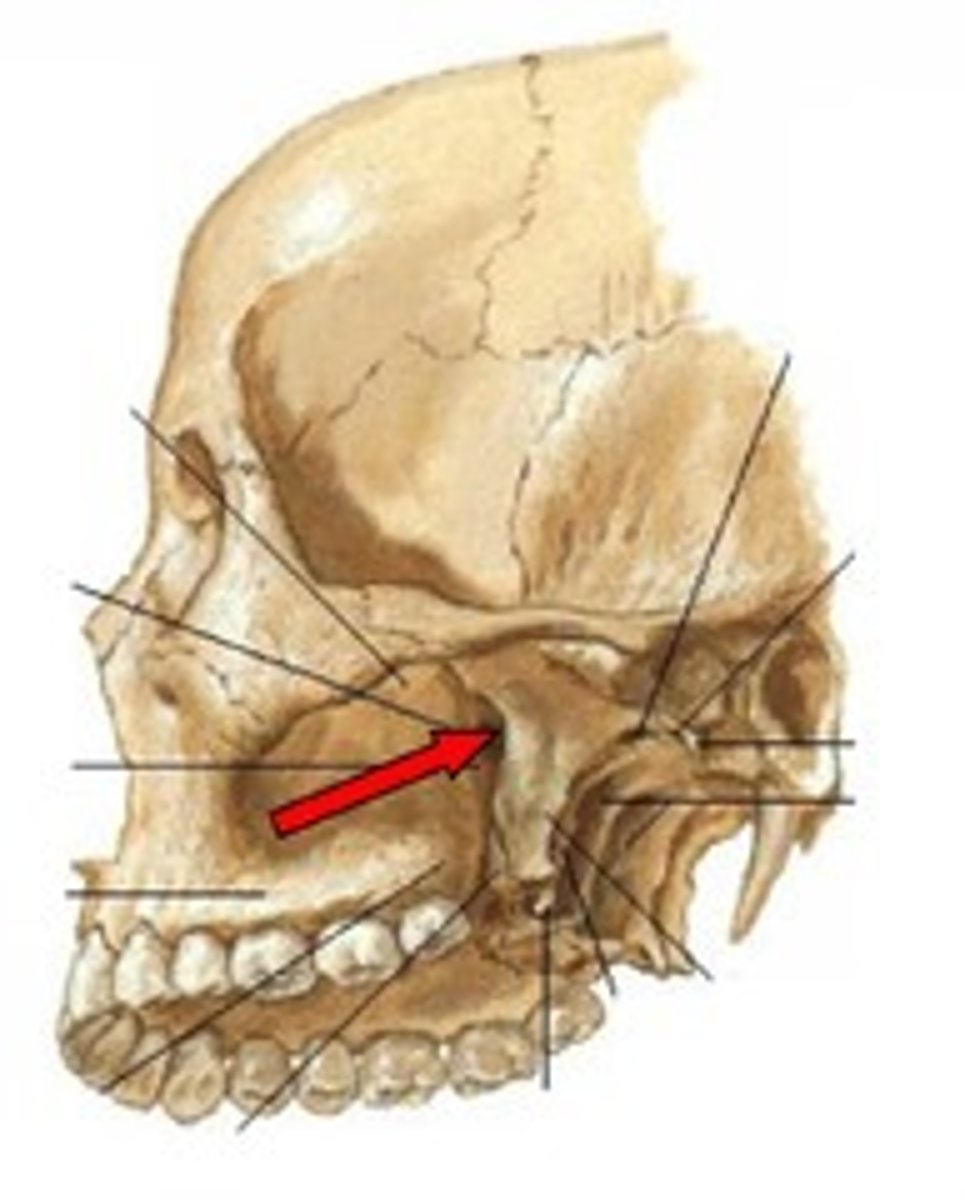 <p>connects infratemporal fossa and pterygopalatine fossa</p>