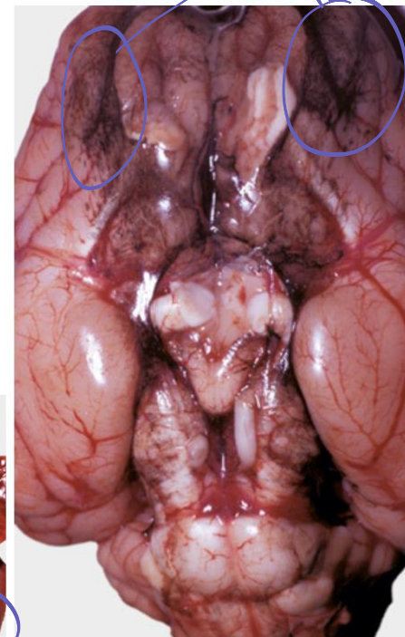 <p>what is being shown on this brain**</p>