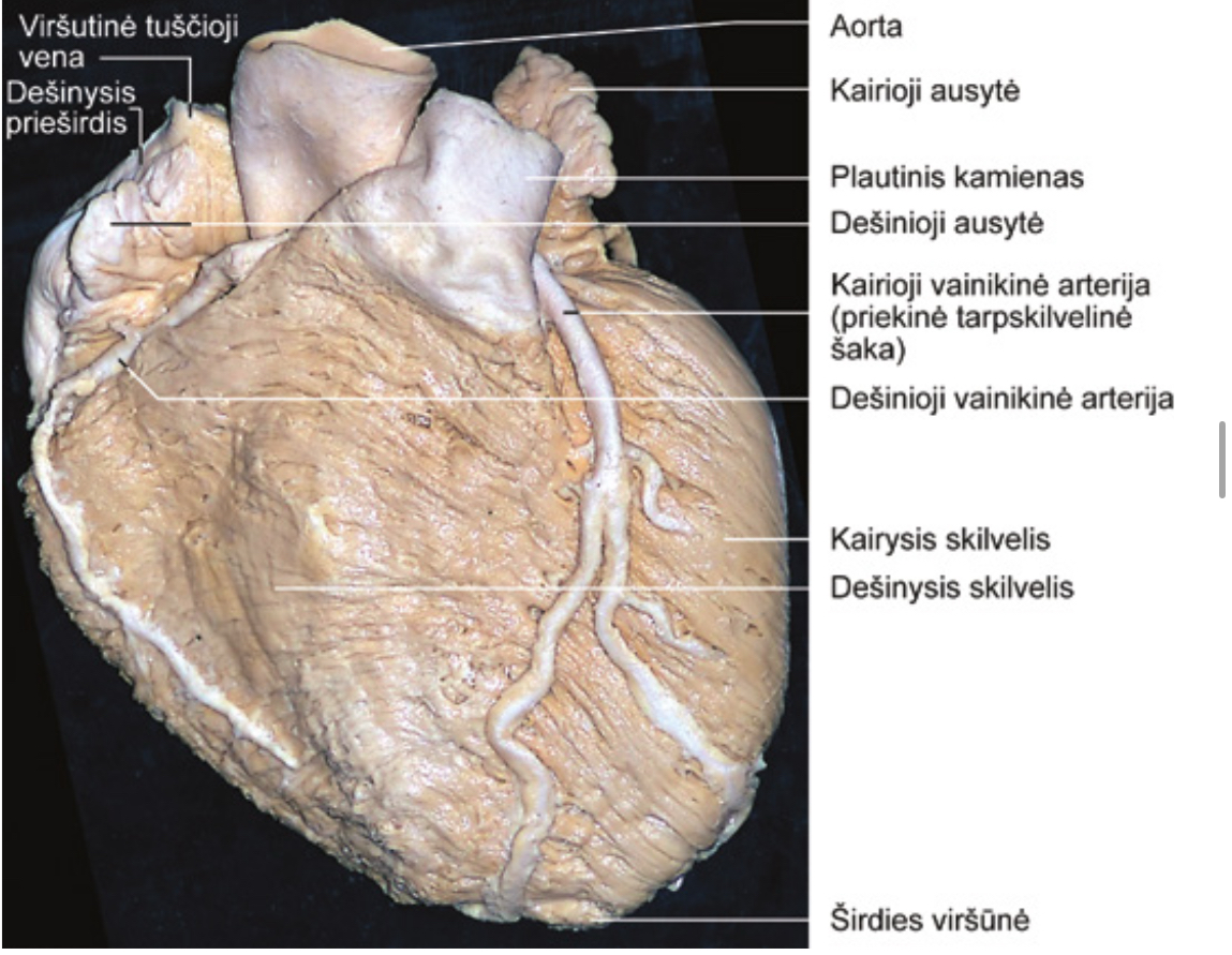 <p>Kairioji vainikine arterija </p><p>Desinioji vainikine arterija</p>