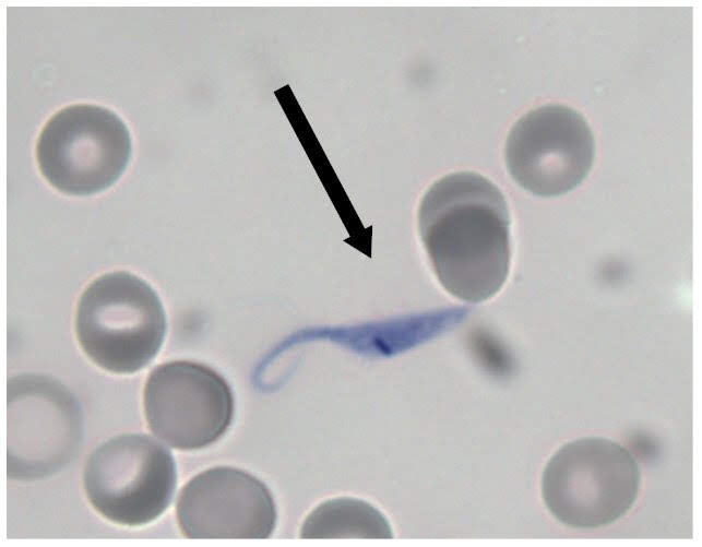 term image