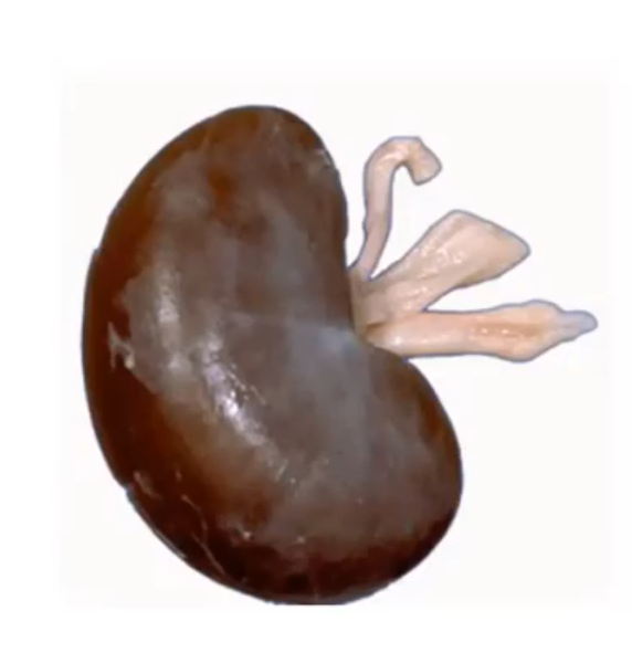 <p>What species has this kidney</p>