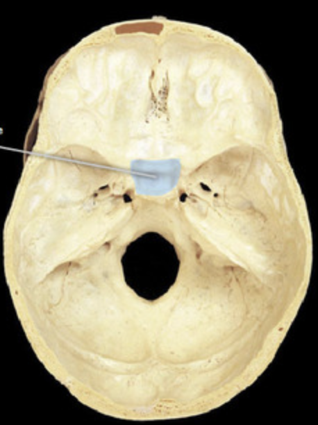 term image