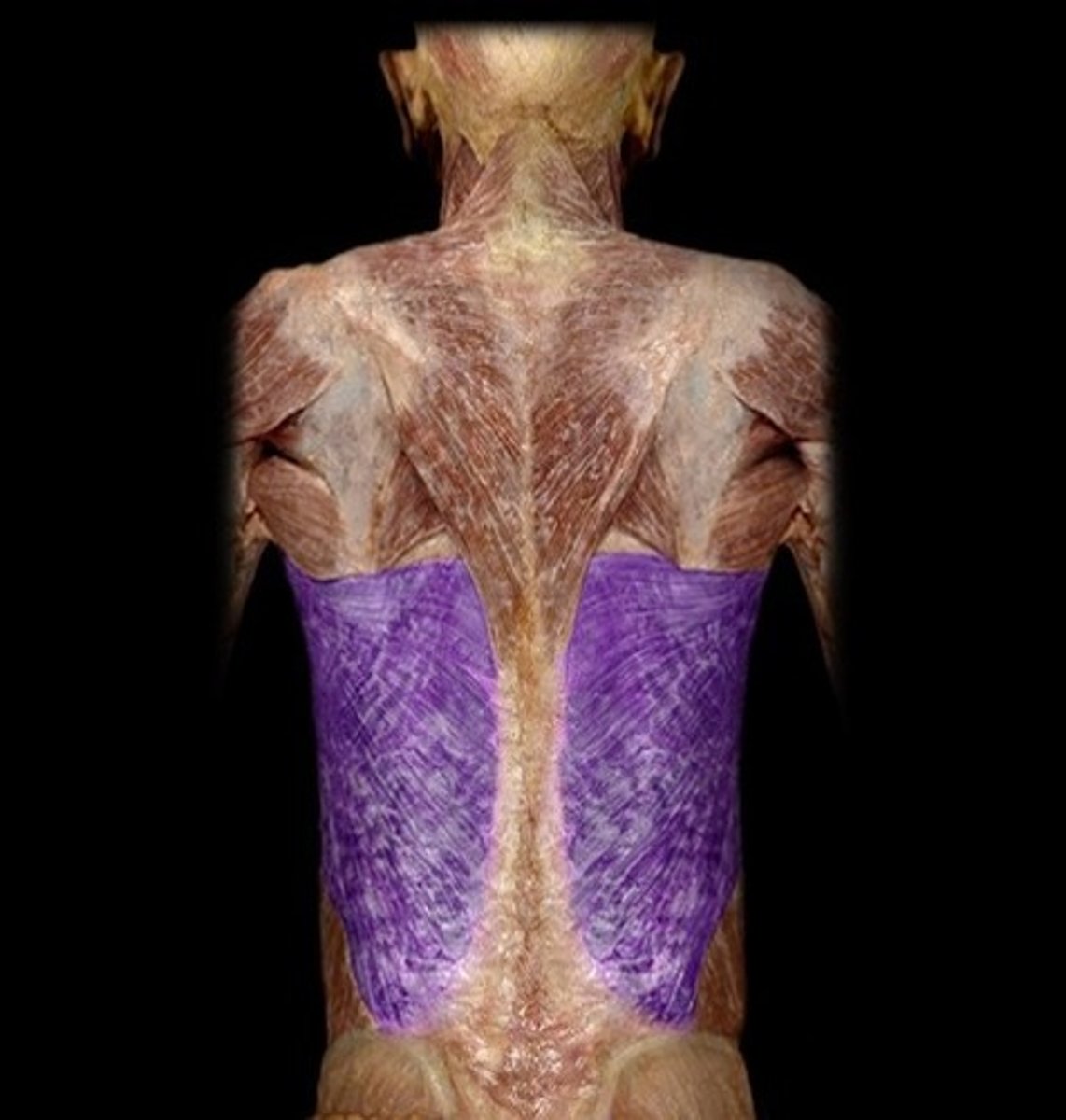 <p>Latissimus Dorsi Action</p>