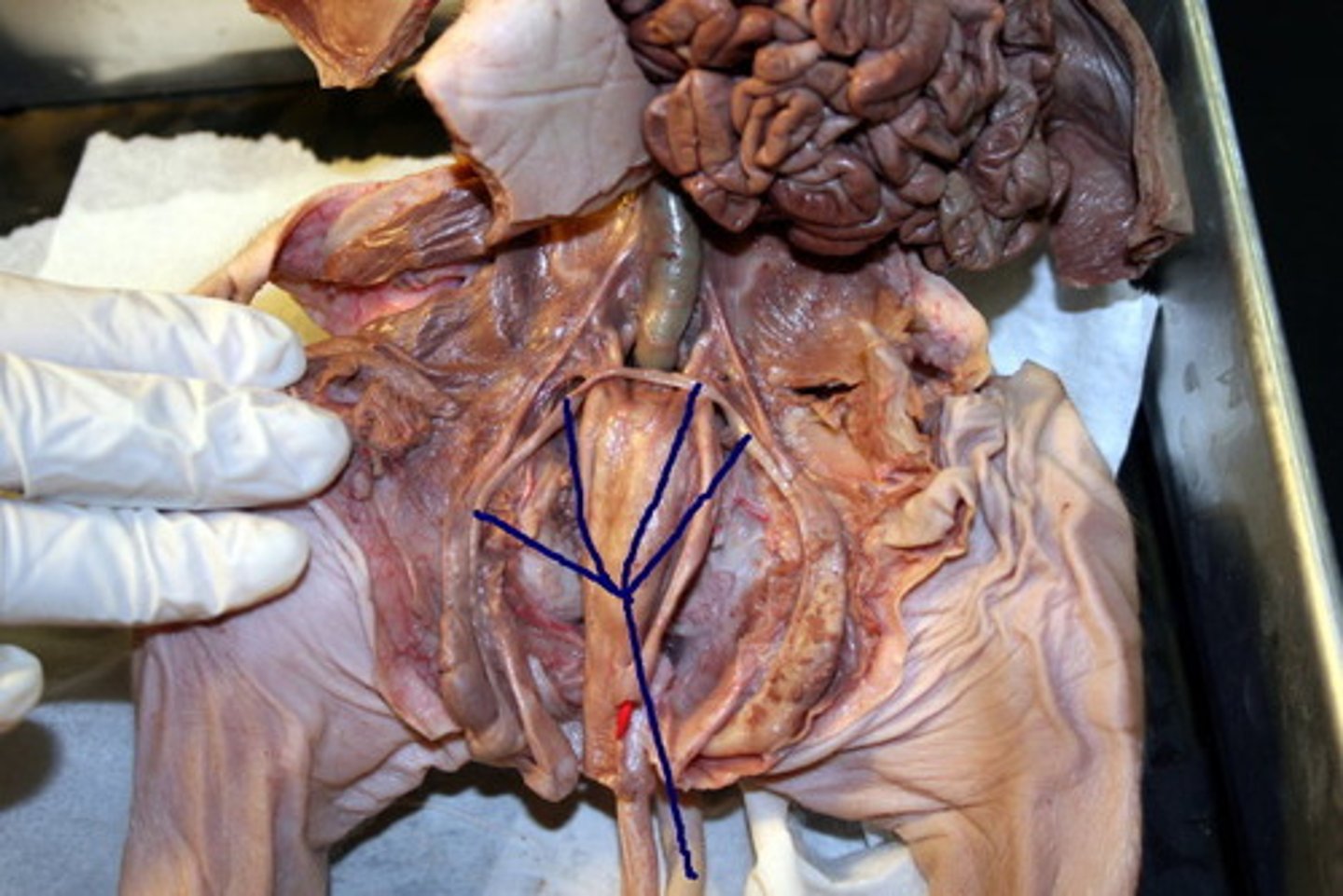 <p>What is the name of this structure? (Runs all the way down to the testes)</p>