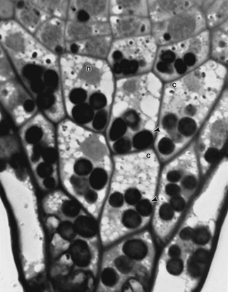 Amyloplasts are important in sensing gravity vectors