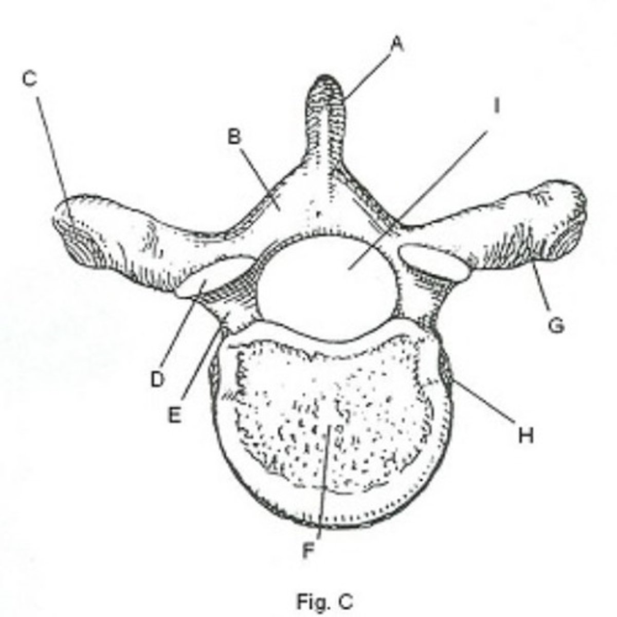 <p>What is letter E?</p><p>pedicle</p><p>lamina</p><p>inferior articular process</p><p>transverse process</p>