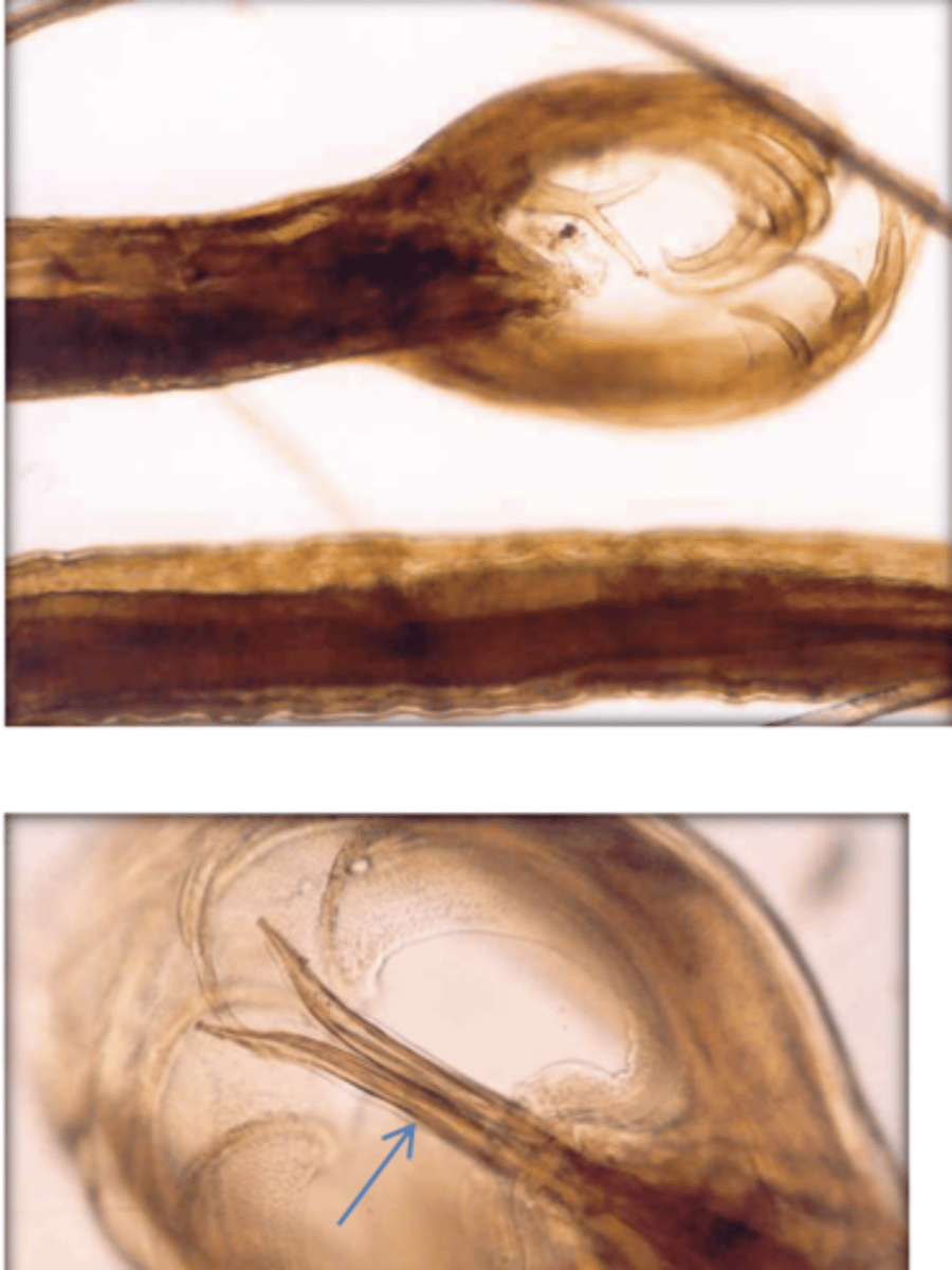 <p>What is this parasite? What characteristic/s did you use to identify it?</p>