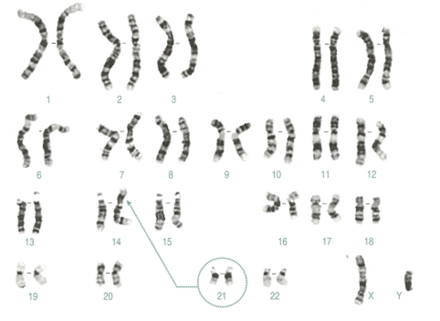 <p>Name:</p><p>- Correctly written karyotype</p><p>- Common name</p><p>- Scientific name</p><p>- One distinguishing clinical feature</p><p>- Definition of this feature if not obvious</p>