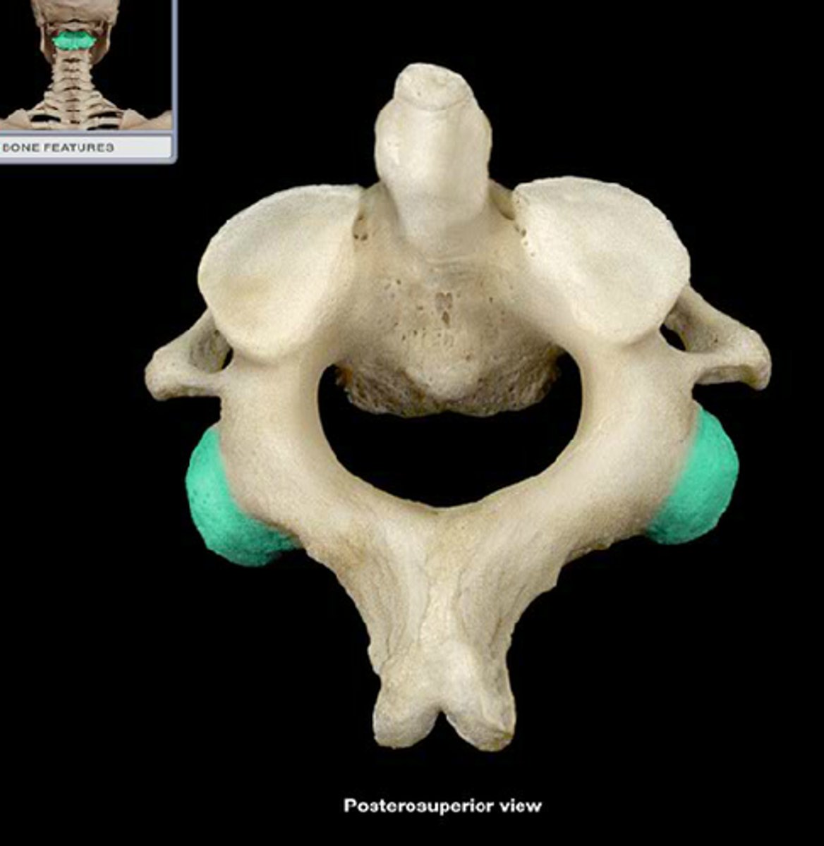 <p>a projection that contacts an adjacent bone; joint with bump</p>