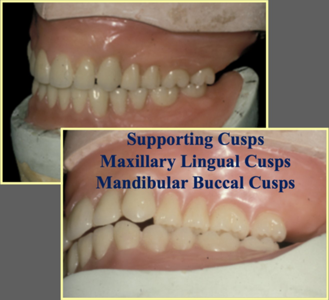<p>maxillary lingual cusps and mandibular buccal cusps</p>
