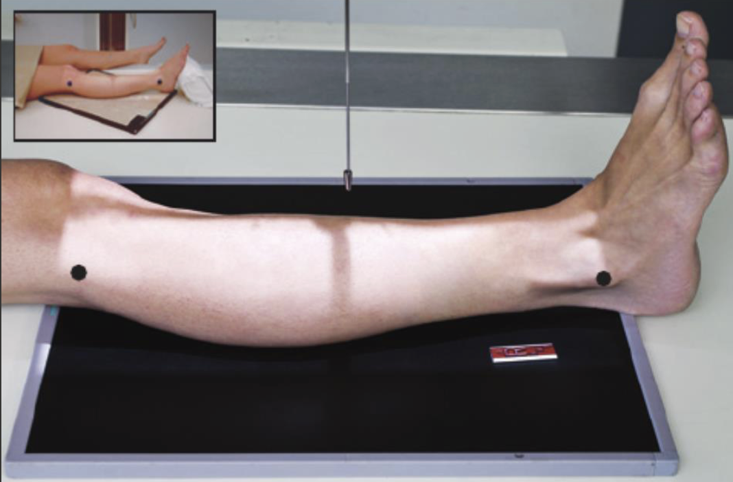 <p>Fine FS, 100cm</p><p>65kVp, 4mAs</p><p>Straight tube</p><p>CR: Midshaft of shin</p>