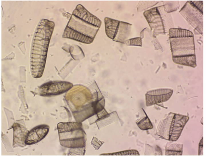 <p>What superphylum do diatoms belong to?</p>