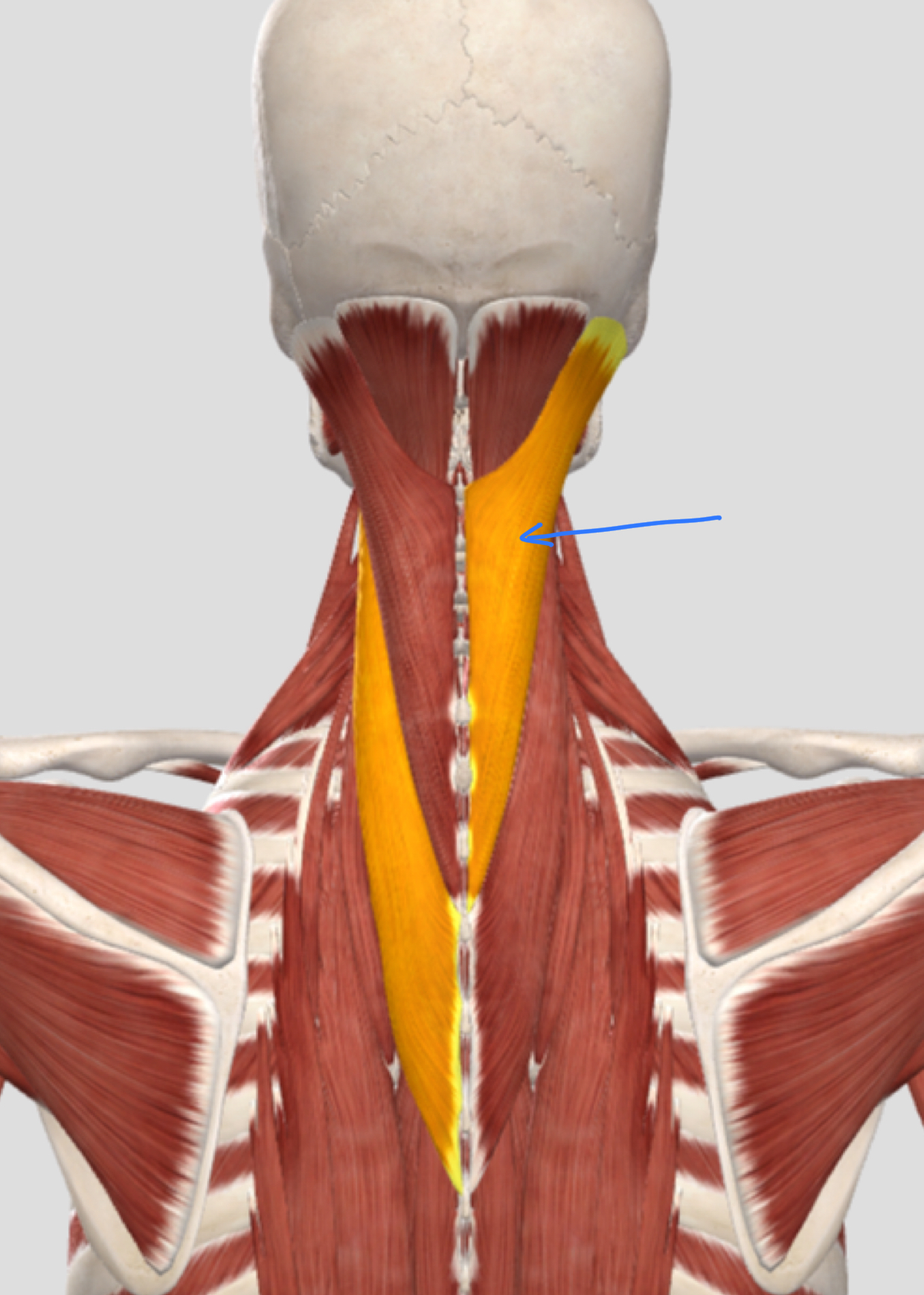 <p>What mm?</p><p>O, I, A bilateral and unilateral</p>