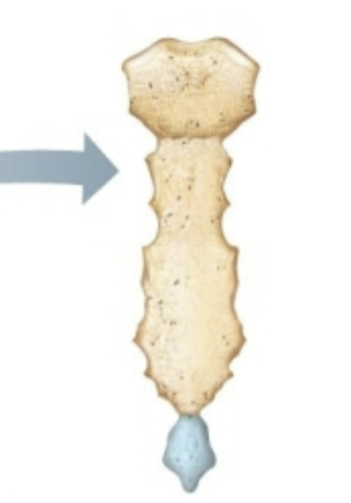 <p>What classification of bone is this?</p>