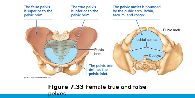 <ul><li><p>Female pelvis tends to be wider, shallower, lighter, and rounder than male’s</p><ul><li><p>Adapted for childbearing</p></li></ul></li><li><p>Pelvic brim</p><ul><li><p>the bony rim (pelvic inlet) that separates the upper "false pelvis" (part of the abdomen) from the lower "true pelvis" (the actual pelvic cavity)</p><ul><li><p>True pelvis: inferior to pelvic brim; defines birth canal</p></li></ul></li></ul></li><li><p>Pelvic outlet: inferior margin of true pelvis</p></li></ul><p></p>