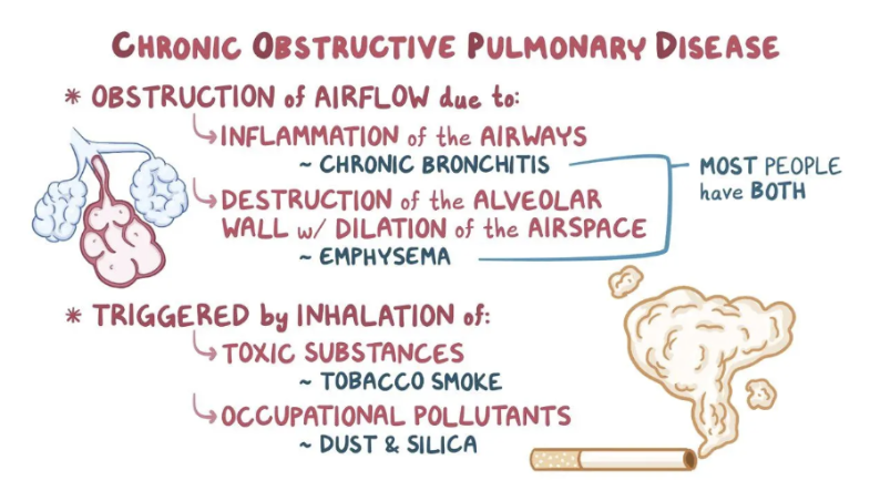 <p>90% av alla patienter med KOL är rökare. Riskfaktorer är:</p><ul><li><p>Rökning</p></li><li><p>Luftföroreningar</p></li><li><p>Hereditet</p></li><li><p>Astma</p></li><li><p>Hög ålder</p></li><li><p><span>Alfa-1-antitrypsinbrist</span></p></li></ul>