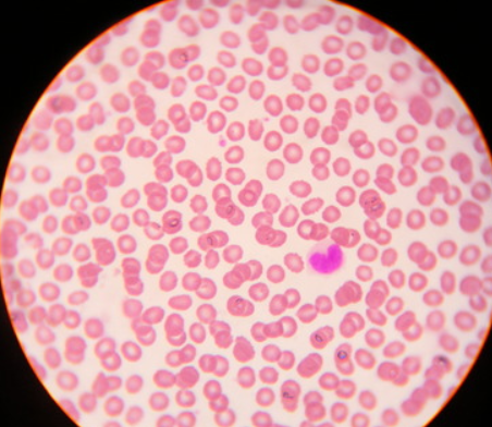 <p>Cells- erythrocytes, leukocytes, platelets <br>Plasma <br>No fibers <br>Function- to carry oxygen and carbon dioxide, nutrients waste and other substances</p>