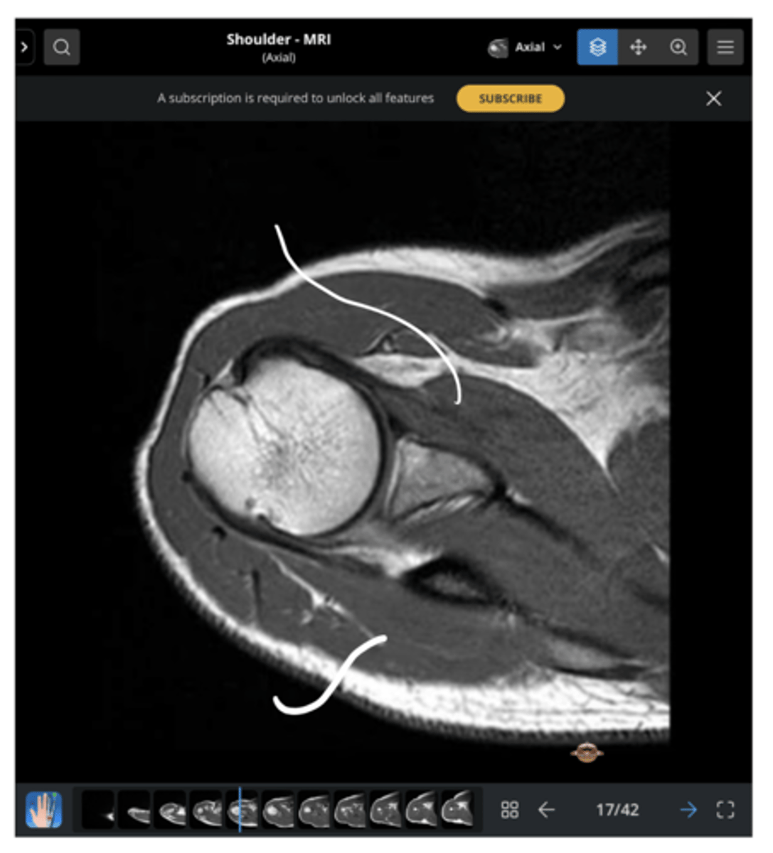 <p>Which structures are being pointed to in this image?</p>