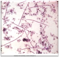 <p>Name this nematode larvae.</p>