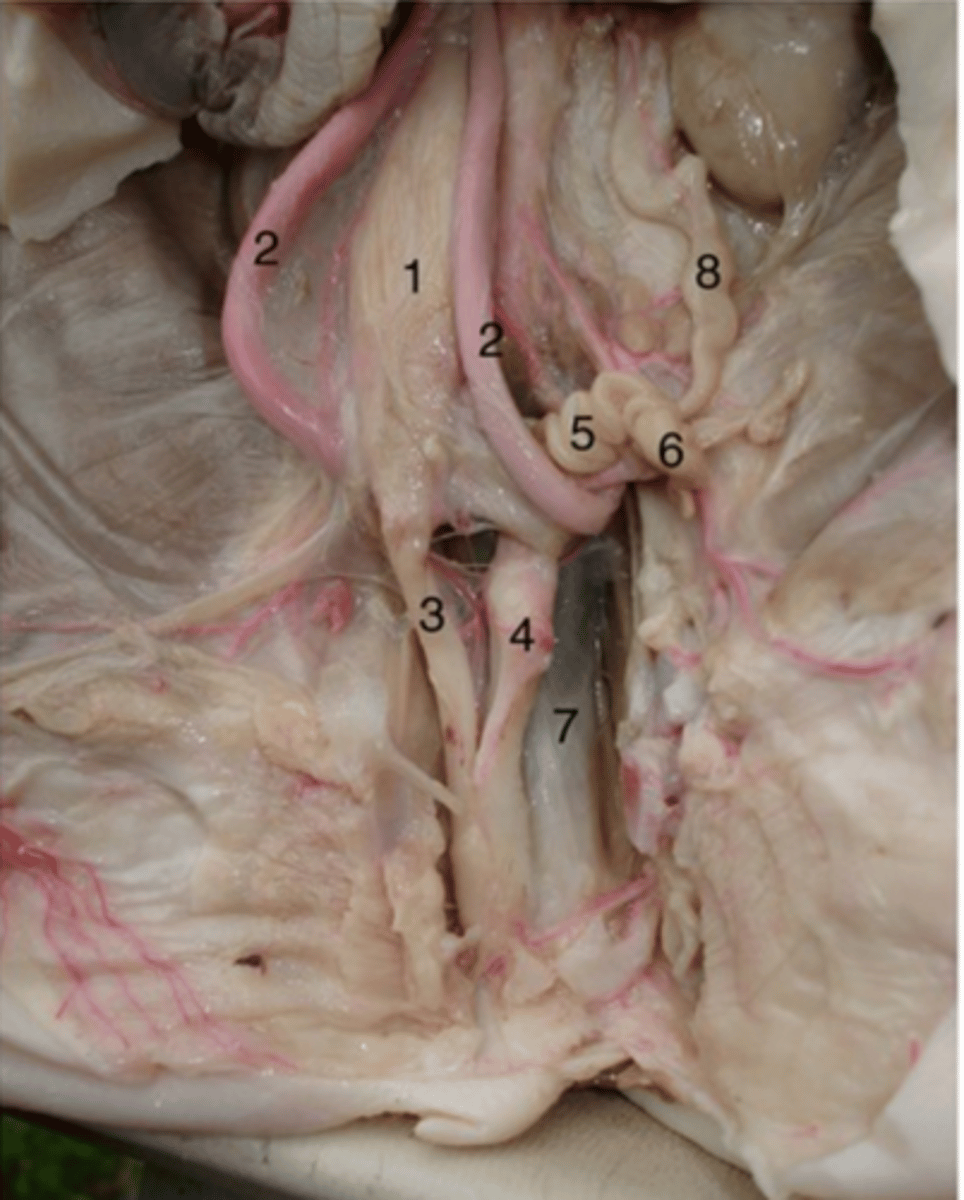 <p>#7</p><p>Temporary storage for feces before being expelled out of body.</p>