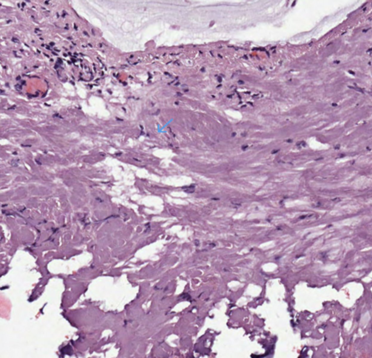 <p>Colon</p>