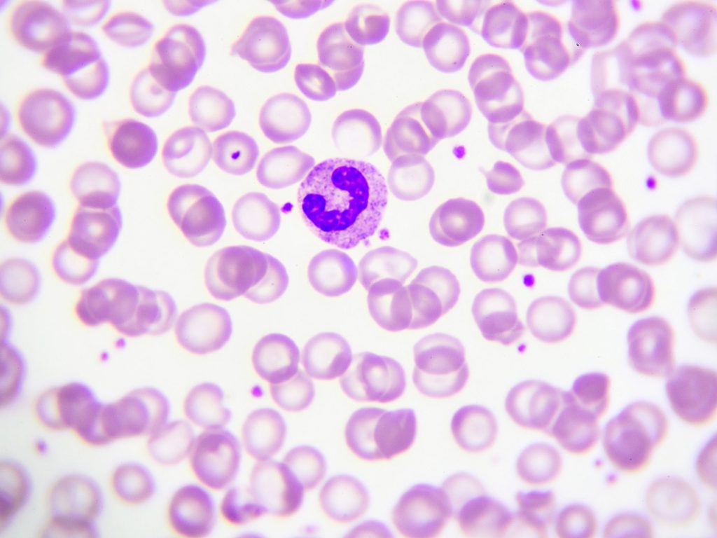 <p>what WBC is the big one (multi nuclei)? what is its cell type? functions?</p>