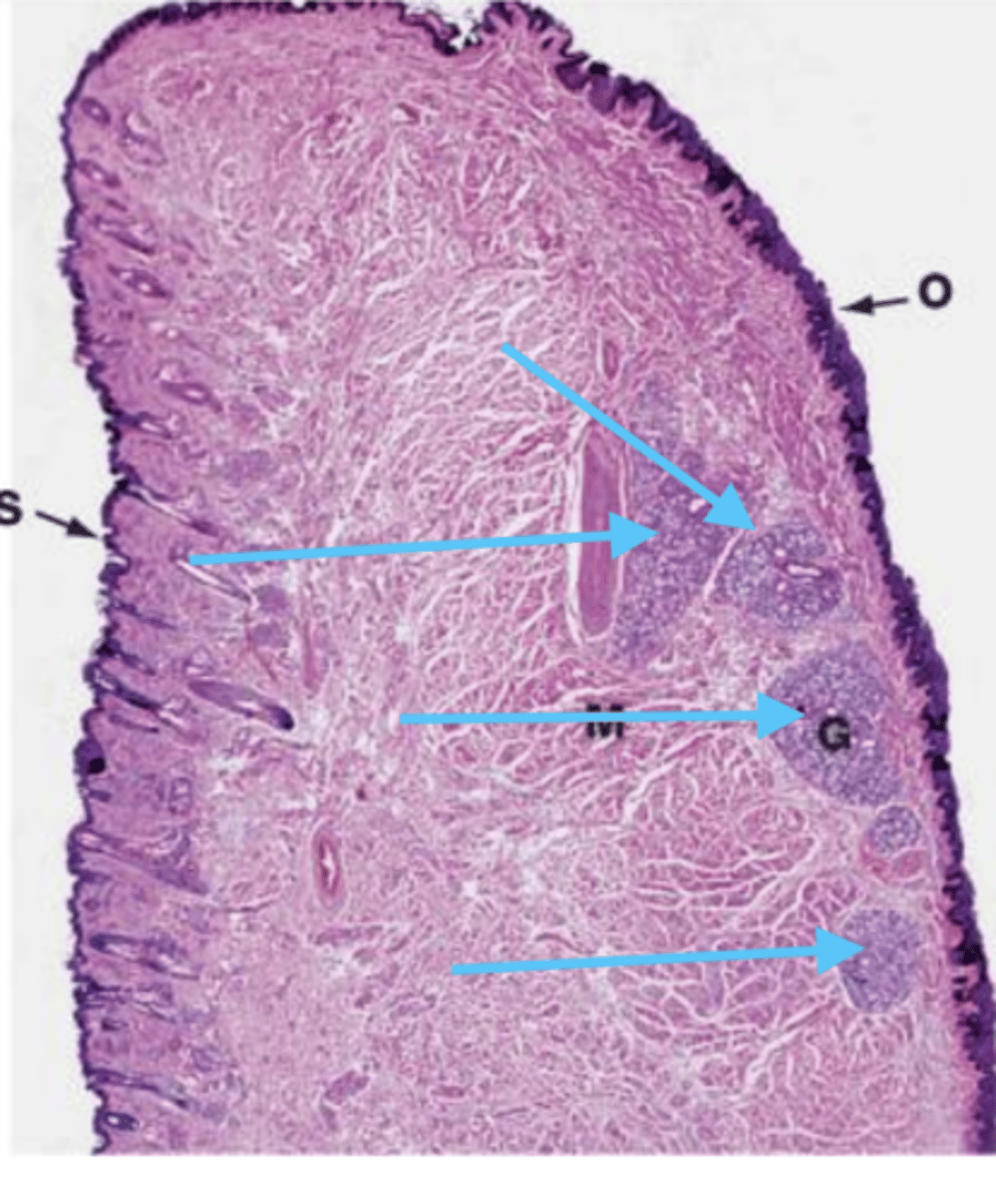 <p>what are these structures?</p>