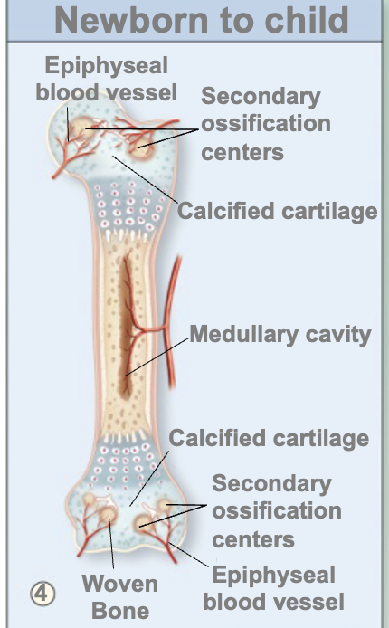 <p>Secondary ossificationcenters form in epiphyses</p><ul><li><p>Cartilage in epiphyses calcifies, chondrocytes die</p></li><li><p>Blood vessels enter carrying osteoprogenitor cells which become osteoblasts active in forming woven bone</p></li><li><p>The woven bone in the diaphysis interior is removed by osteoclasts, forming the medullary cavity</p></li><li><p>Lengthwise growth occurs at epiphyseal plate until</p></li></ul><p>Step 3 to ______</p>