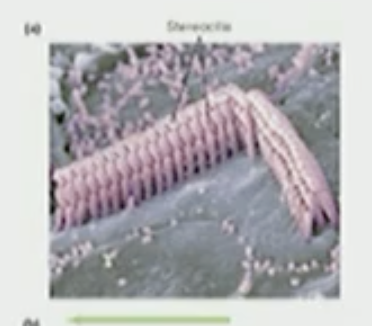 <p>Stereocilia</p>