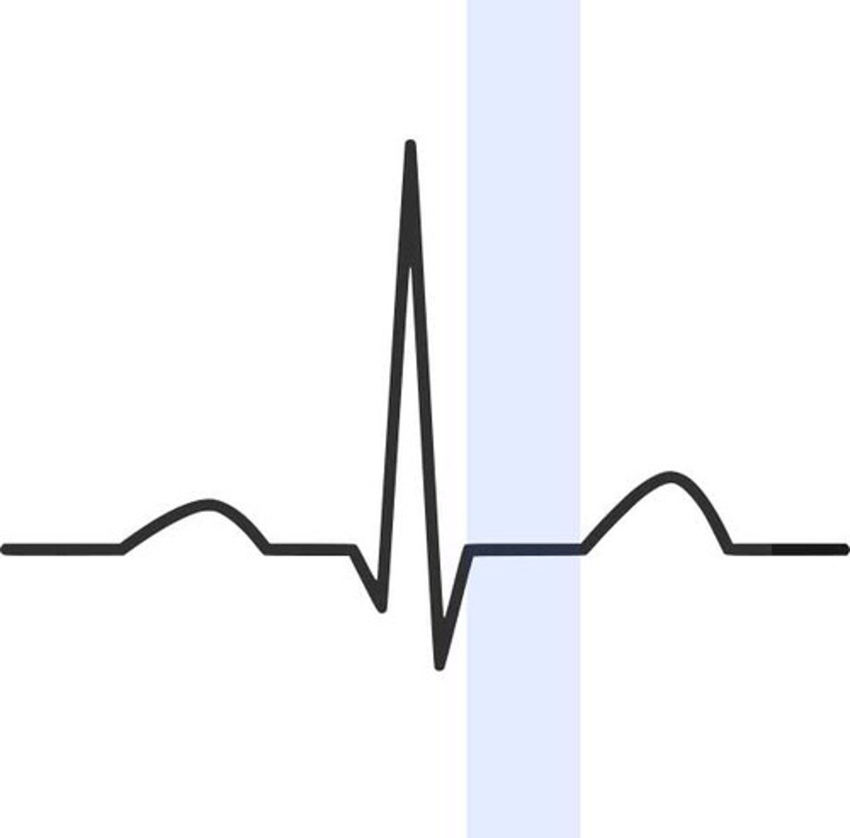 <p>Beginning of ventricular repolarization (relaxation); should be isoelectric</p>