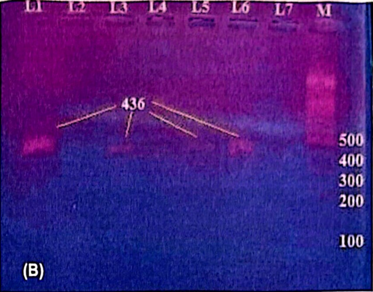 <p>Dựa trên hình ảnh gel điện di, nguyên nhân gây ra hiện tượng trên có thể là do:</p><p>A. EtBr được pha vào gel agarose với tỉ lệ vừa đủ</p><p>B. SYBR được pha vào gel agarose với tỉ lệ vừa đủ</p><p>C. Gel agarose có quá ít SYBR</p><p>D. Gel agarose có quá ít EtBr</p>