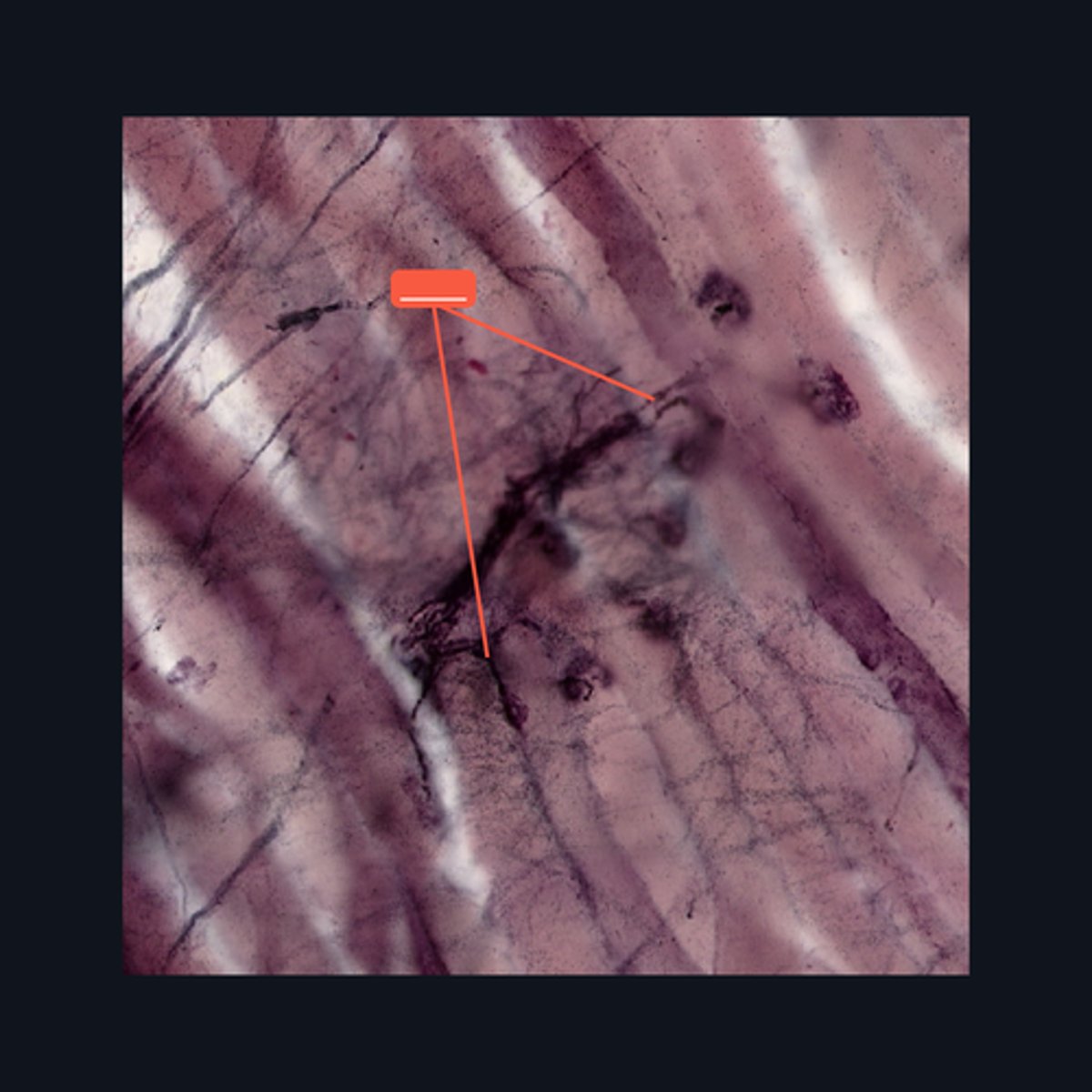 <p>Identify the structure</p>