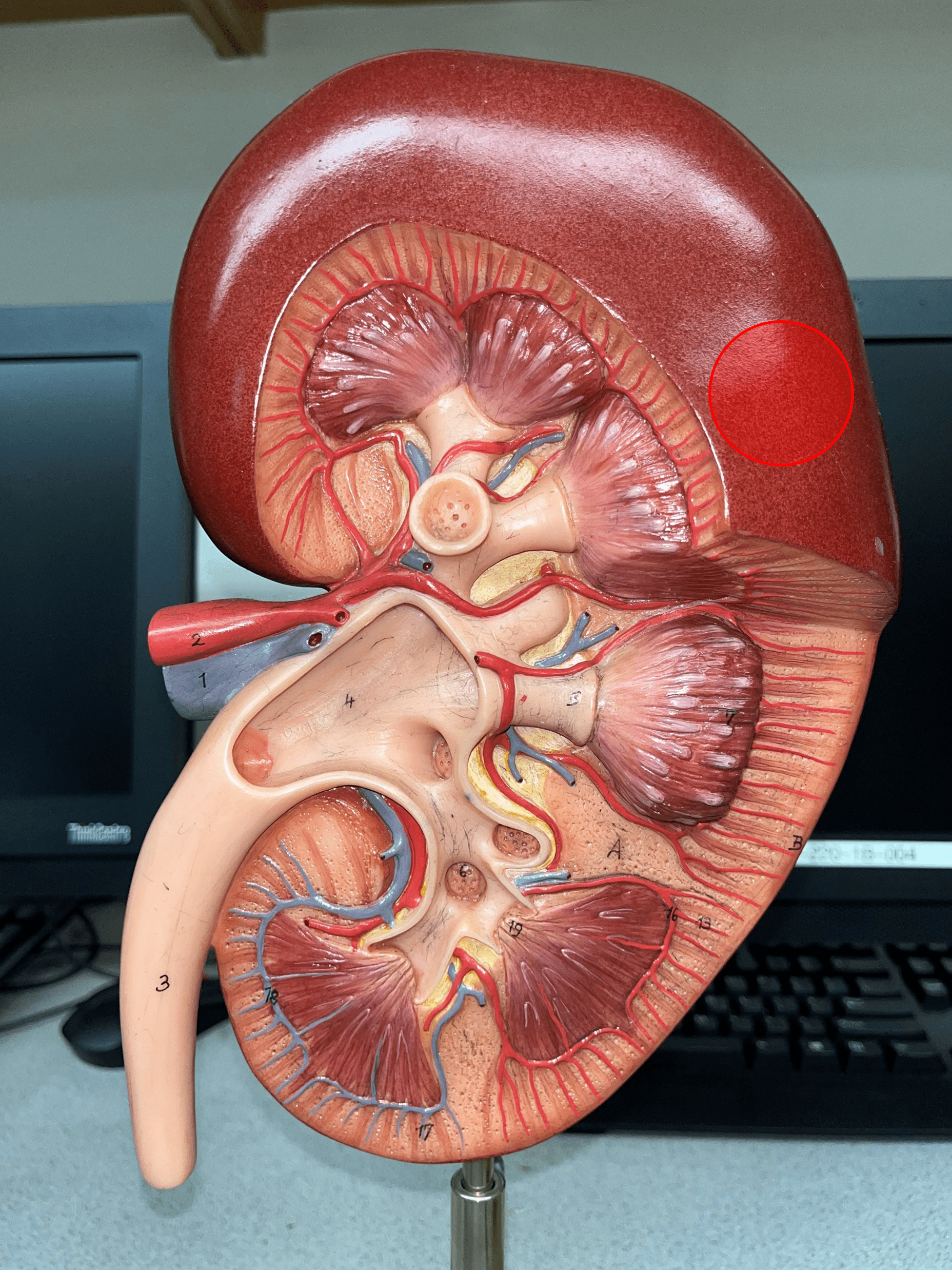 The thin outer shell of the kidney.