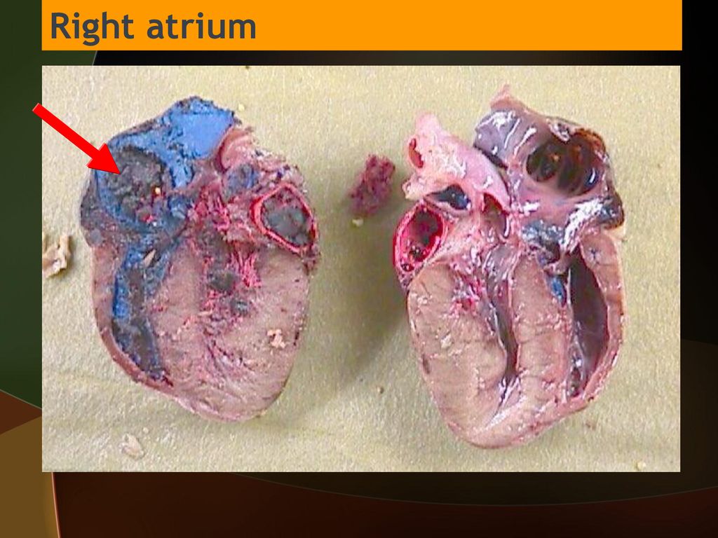 <p></p><p>The right atrium receives deoxygenated blood from the body, while the left atrium receives oxygenated blood from the lungs. Both atria contract to pump blood into the respective ventricles for further circulation.</p>