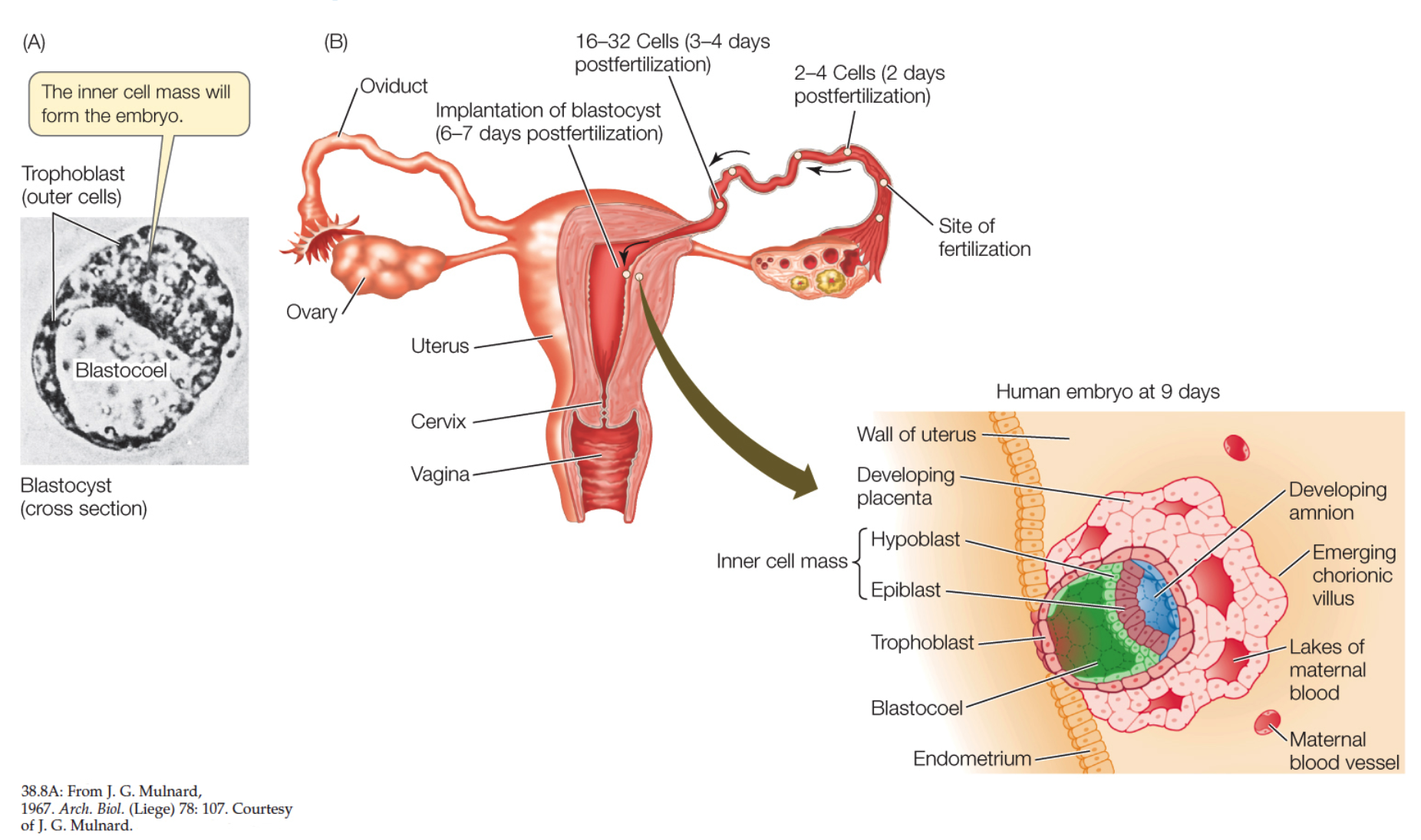 <p><strong>Human Blastocyst at Implantation</strong></p><ul><li><p>(A) The mammalian blastocyst consists of an inner cell mass adjacent to a fluid-filled blastocoel and surrounded by trophoblast cells.</p></li><li><p>(B) Molecules and enzymes secreted by trophoblast cells allow the blastocyst to adhere to and burrow into the ______.</p><ul><li><p>Once the blastocyst is implanted in the uterine wall, the _____ cells send out _____ villi—projections that increase the embryo’s area of contact with the maternal bloodstream</p></li></ul></li></ul>