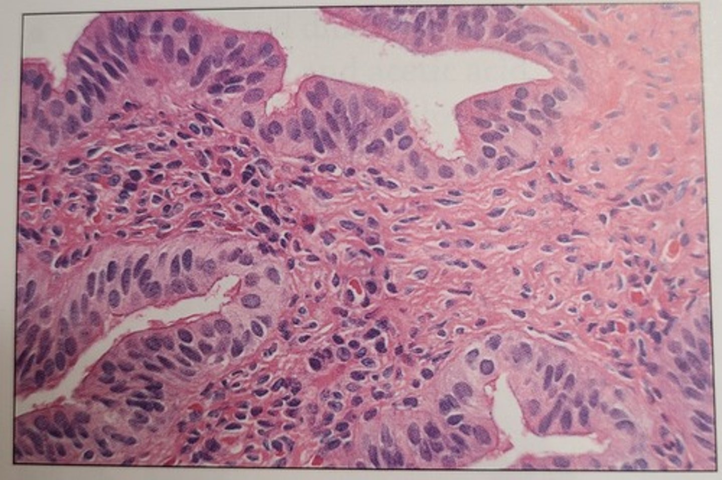 <p>c. incomplete fixation</p><p>- The smudgy nuclei, or lack of chromatin definition, seen in this image is attributed to incomplete fixation of the tissue</p>
