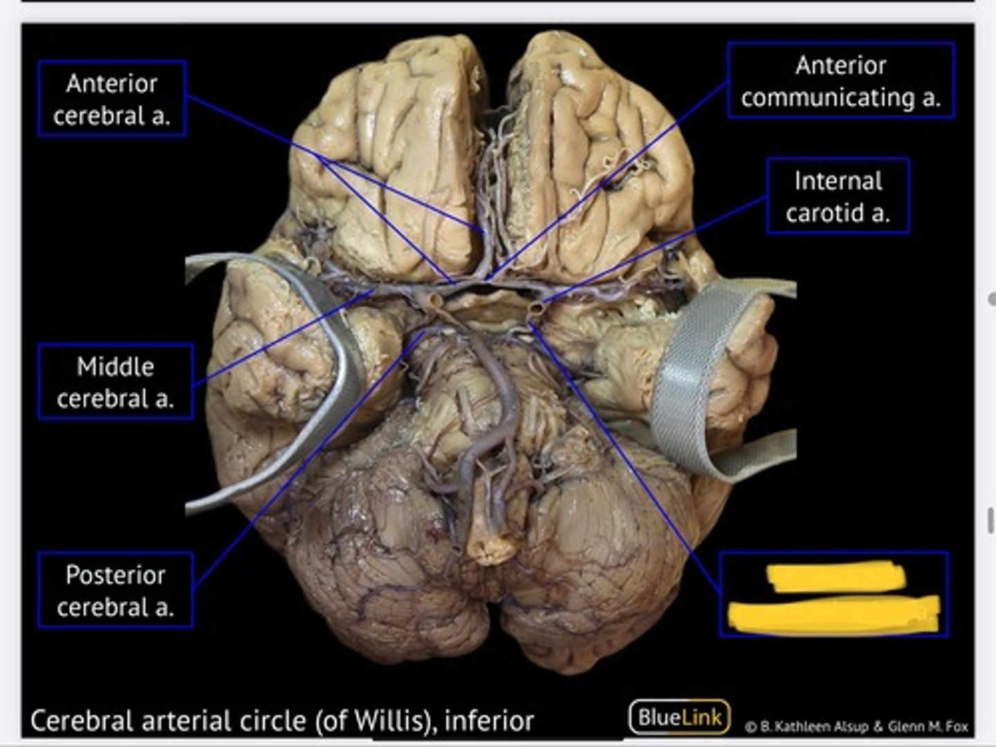 knowt flashcard image