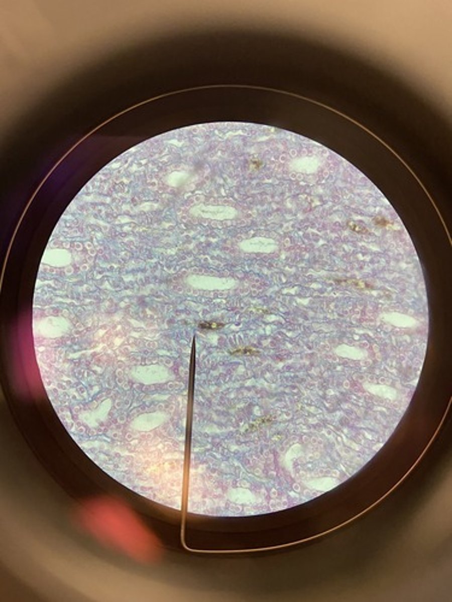 <p>Kidney tubules; ducts and secretory portions of small glands, ovary surface.</p>