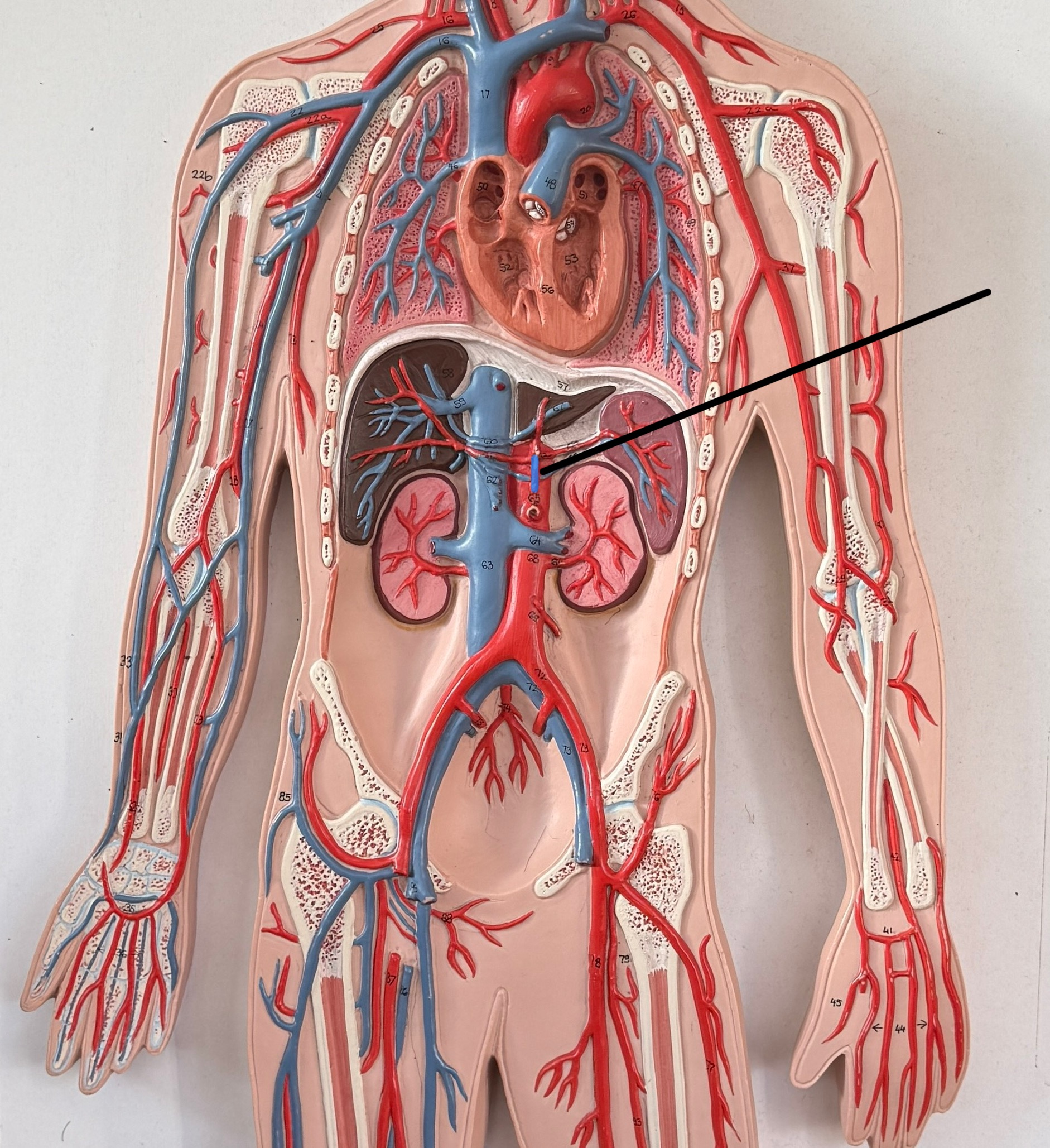 <p>Which artery is this?</p>