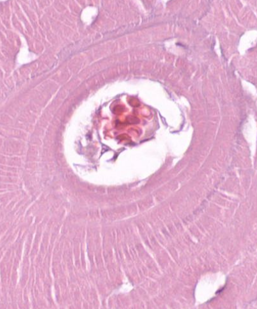 <p>vasculature in the center of the canal</p>