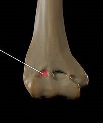 <p>lateral</p>