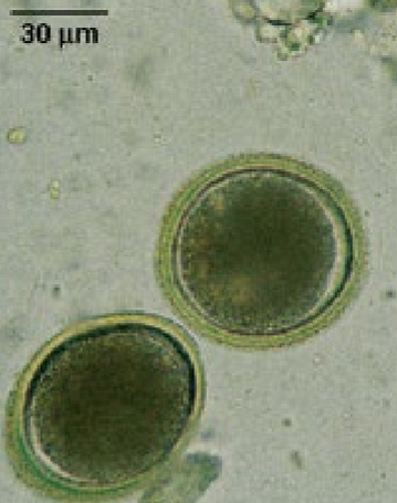 <p>Similar to<em> T. canis</em>, just smaller</p>