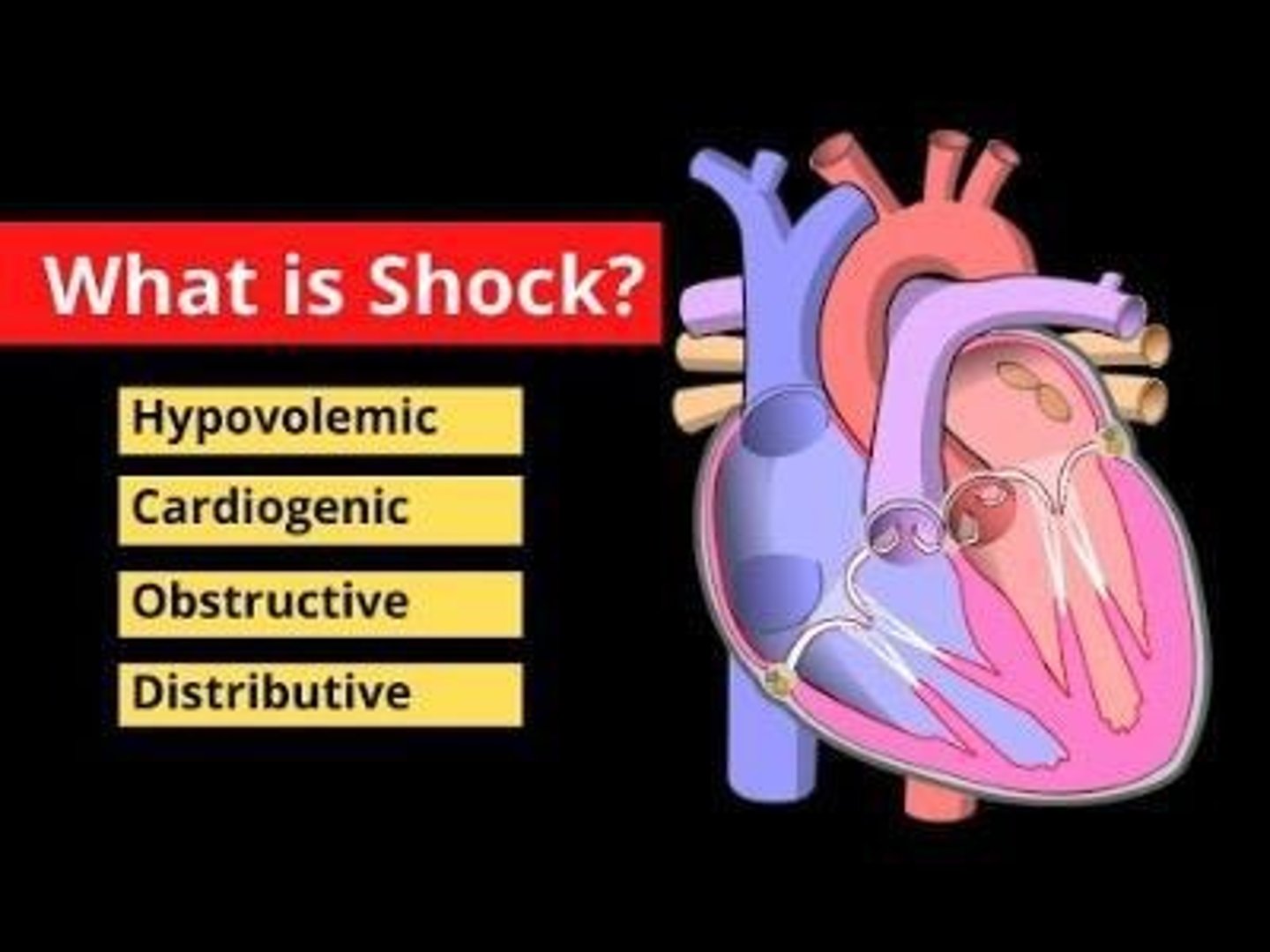 <p>Cardiogenic, hypovolemic, distributive, and obstructive.</p>